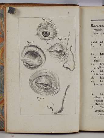 [OPHTALMOLOGIE] - [Ensemble de 3 volumes :] 