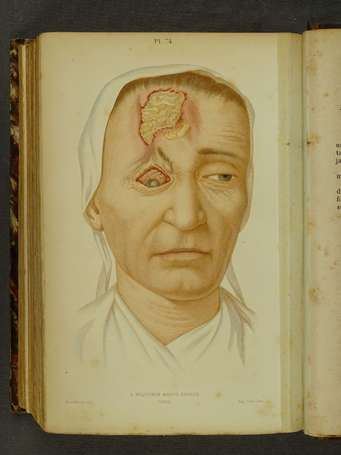 [MÉDECINE] - CULLERIER (A.) - Précis 